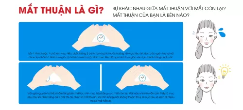 Mắt thuận là gì?